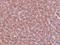 Lysine Demethylase 4A antibody, A02850, Boster Biological Technology, Immunohistochemistry paraffin image 
