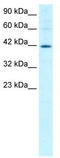 Mesoderm induction early response protein 1 antibody, TA335495, Origene, Western Blot image 