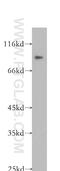 Plakophilin 3 antibody, 18338-1-AP, Proteintech Group, Western Blot image 