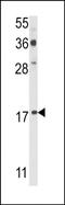 P53 And DNA Damage Regulated 1 antibody, PA5-72503, Invitrogen Antibodies, Western Blot image 