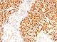 Myogenin antibody, NBP2-44328, Novus Biologicals, Immunohistochemistry frozen image 