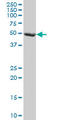 F-box/LRR-repeat protein 3 antibody, LS-C139268, Lifespan Biosciences, Western Blot image 