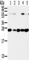 Synaptosome Associated Protein 23 antibody, TA350431, Origene, Western Blot image 