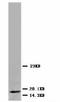 Myoglobin antibody, LS-C171195, Lifespan Biosciences, Western Blot image 