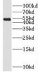 Spermatid Associated antibody, FNab08172, FineTest, Western Blot image 