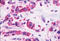 Cadherin EGF LAG seven-pass G-type receptor 2 antibody, MBS244803, MyBioSource, Immunohistochemistry frozen image 