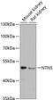 Netrin 5 antibody, 14-848, ProSci, Western Blot image 