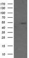 MDM4 Regulator Of P53 antibody, TA505736, Origene, Western Blot image 