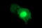 Mucosal Vascular Addressin Cell Adhesion Molecule 1 antibody, M04227-1, Boster Biological Technology, Immunofluorescence image 