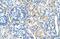 Signal Peptide Peptidase Like 2B antibody, A07360, Boster Biological Technology, Immunohistochemistry paraffin image 