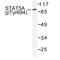 STAT5A antibody, AP01696PU-N, Origene, Western Blot image 