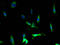 C-C Motif Chemokine Receptor 1 antibody, A62214-100, Epigentek, Immunofluorescence image 
