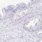 Sarcalumenin antibody, HPA041535, Atlas Antibodies, Immunohistochemistry paraffin image 