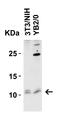 Barrier To Autointegration Factor 1 antibody, A02734-1, Boster Biological Technology, Western Blot image 
