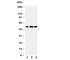 5-Hydroxytryptamine Receptor 3A antibody, R30690, NSJ Bioreagents, Western Blot image 