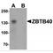 Zinc Finger And BTB Domain Containing 40 antibody, MBS151056, MyBioSource, Western Blot image 