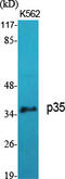 Cyclin-dependent kinase 5 activator 1 antibody, GTX34250, GeneTex, Western Blot image 