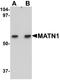 Matrilin 1 antibody, NBP1-77350, Novus Biologicals, Western Blot image 