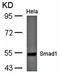 SMAD Family Member 1 antibody, orb14693, Biorbyt, Western Blot image 