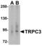 Transient Receptor Potential Cation Channel Subfamily C Member 3 antibody, LS-C358502, Lifespan Biosciences, Western Blot image 