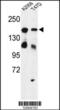 High Density Lipoprotein Binding Protein antibody, 63-936, ProSci, Western Blot image 