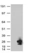 KRAS Proto-Oncogene, GTPase antibody, CF801672, Origene, Western Blot image 