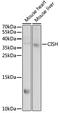 Cytokine-inducible SH2-containing protein antibody, 22-101, ProSci, Western Blot image 