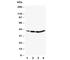 CCAAT/enhancer-binding protein alpha antibody, R30531, NSJ Bioreagents, Western Blot image 