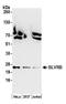 Biliverdin Reductase B antibody, A305-569A, Bethyl Labs, Western Blot image 