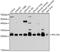 Ribosomal Protein L10a antibody, GTX66471, GeneTex, Western Blot image 