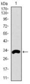 FceRIa antibody, abx015856, Abbexa, Western Blot image 