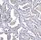 Mannose Phosphate Isomerase antibody, A00175, Boster Biological Technology, Immunohistochemistry frozen image 