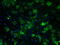 ATP Synthase F1 Subunit Beta antibody, TA500851, Origene, Immunofluorescence image 