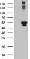 Proteasome 26S Subunit, Non-ATPase 5 antibody, TA811921, Origene, Western Blot image 