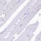Sorbitol Dehydrogenase antibody, HPA040260, Atlas Antibodies, Immunohistochemistry paraffin image 