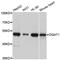 Diacylglycerol O-acyltransferase 1 antibody, STJ28938, St John