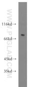 Dipeptidyl Peptidase 8 antibody, 12752-1-AP, Proteintech Group, Western Blot image 