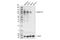 Integrin Subunit Beta 2 antibody, 47598S, Cell Signaling Technology, Western Blot image 