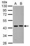 Septin-2 antibody, NBP2-20301, Novus Biologicals, Western Blot image 