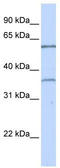 T-Box 15 antibody, TA342502, Origene, Western Blot image 