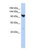 Armadillo Repeat Containing 3 antibody, NBP1-70412, Novus Biologicals, Western Blot image 