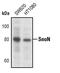 SKI Like Proto-Oncogene antibody, PA5-17340, Invitrogen Antibodies, Western Blot image 