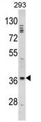 Homeobox protein DLX-2 antibody, AP17285PU-N, Origene, Western Blot image 
