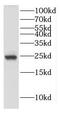 Deleted In Primary Ciliary Dyskinesia Homolog (Mouse) antibody, FNab02512, FineTest, Western Blot image 