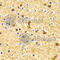 Bridging Integrator 1 antibody, A1792, ABclonal Technology, Immunohistochemistry paraffin image 
