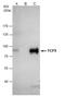 Transcription Factor 3 antibody, GTX129237, GeneTex, Immunoprecipitation image 