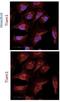T-lymphoma invasion and metastasis-inducing protein 1 antibody, NBP2-75096, Novus Biologicals, Immunocytochemistry image 