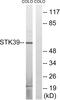 Serine/Threonine Kinase 39 antibody, abx012939, Abbexa, Western Blot image 