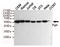 FYN Proto-Oncogene, Src Family Tyrosine Kinase antibody, TA346951, Origene, Western Blot image 