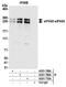 Eukaryotic translation initiation factor 4 gamma 3 antibody, A301-768A, Bethyl Labs, Immunoprecipitation image 